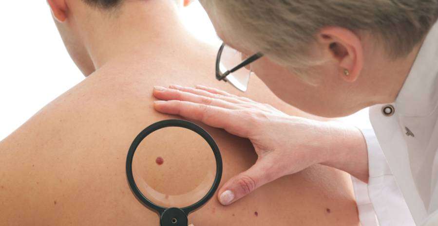 Hány anyajegyet lehet eltávolítani egyszerre?