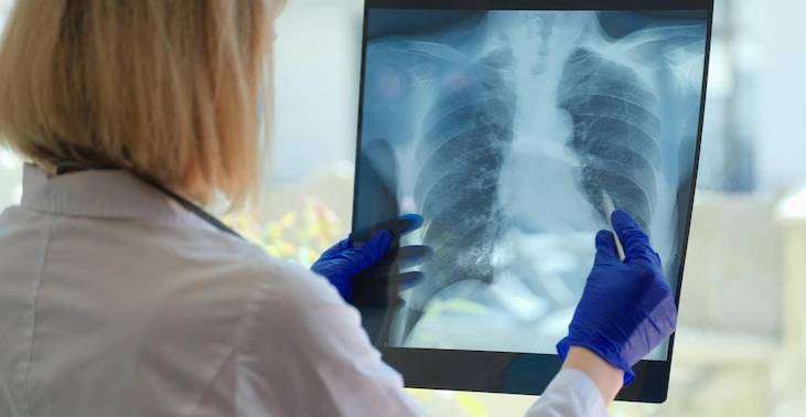 Hogyan kezelhető a COPD?