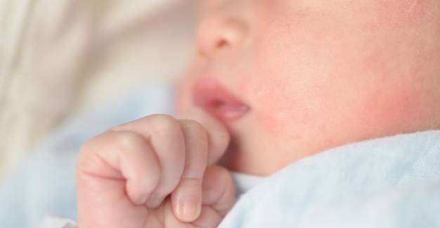 Mi okozhatja a csecsemőkori ekcémát?