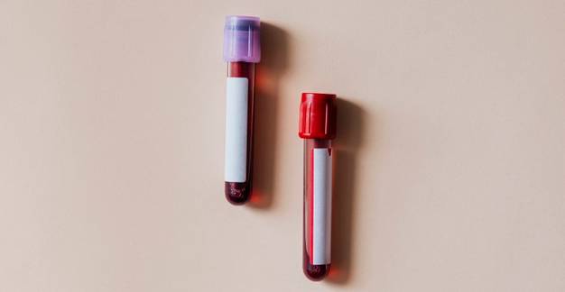 Milyen esetekben csökkenhet a vérlemezkék száma a vérben?