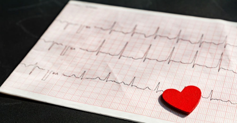 EKG a szív hipertóniája esetén