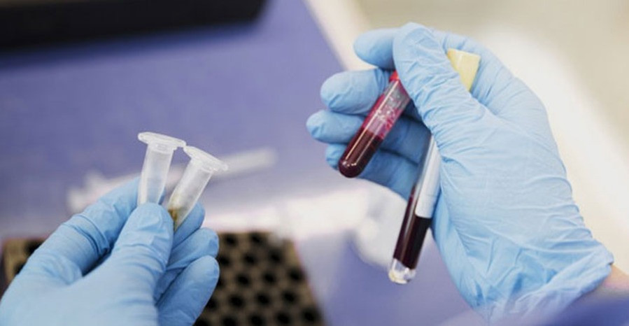 Laborvizsgálat: vérvétel